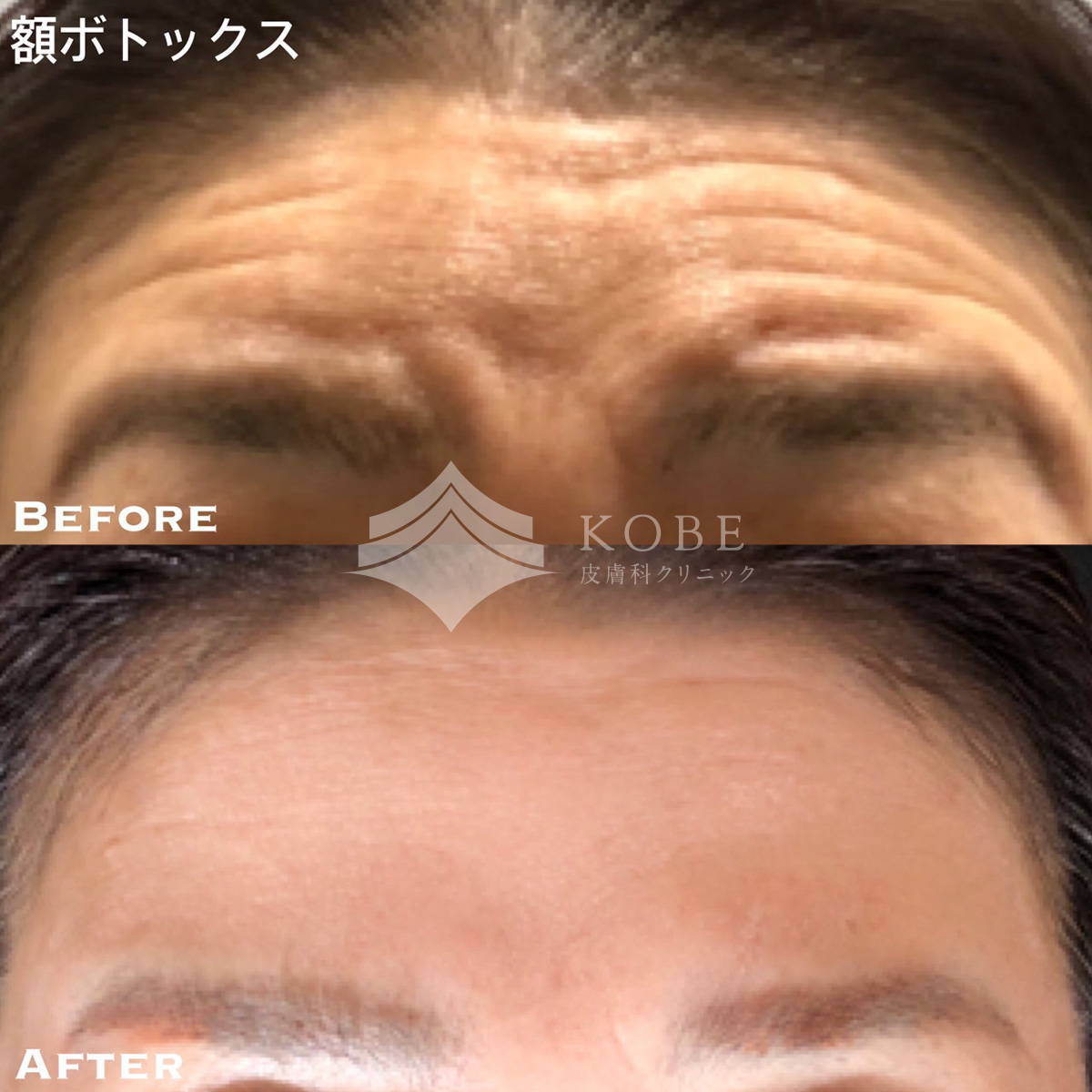 No.904の症例写真
